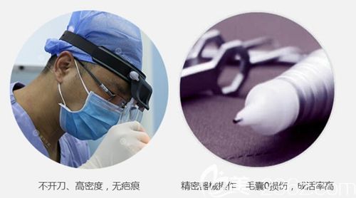 重庆华美植发技术