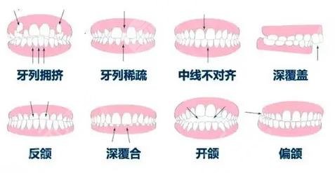 口腔问题