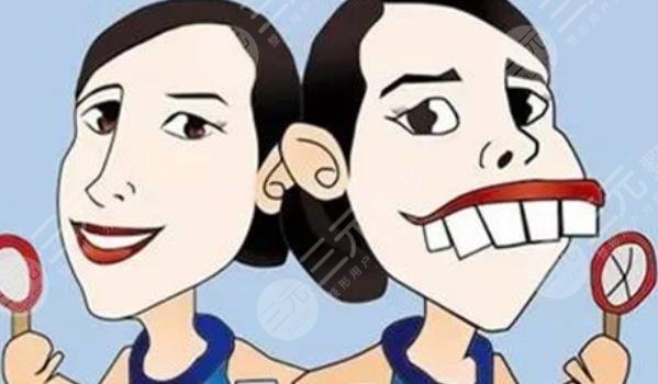 南方医科大学南方医院牙齿矫正案例