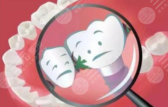 种植牙价格影响因素