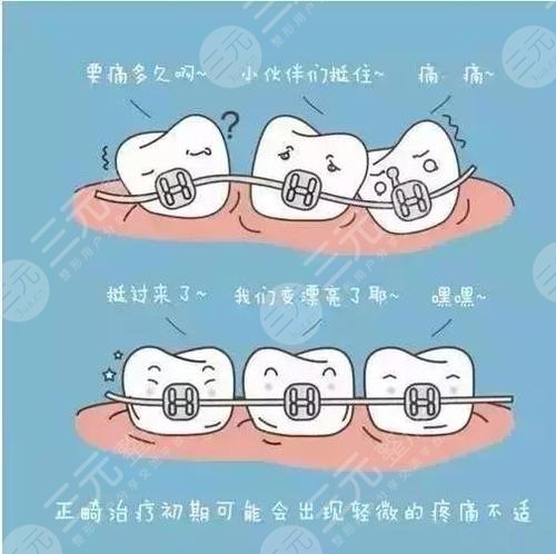 中山一院牙科成功牙齿矫正案例：术后