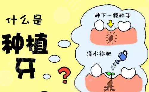 种植牙收费表公布!多少钱一颗、优点、适合人群全科普! 种植牙收费表公布!多少钱一颗、优点、适合人群全科普!