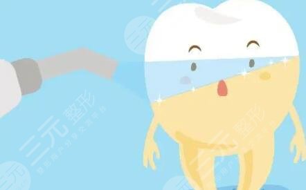 冷光牙齿美白安全吗?