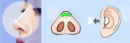 北京八大处杨欣做鼻子项目科普