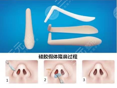 北京协和医院整形科协和王阳隆鼻前