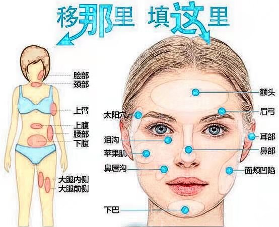 北京东方和谐孙泽芳面部填充术前