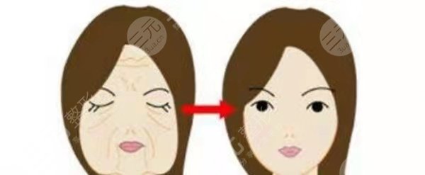 北京东方瑞丽整形医院面部多维拉提升前
