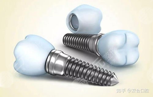 北京维尔口腔医院种植牙怎么样?