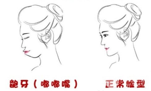 上海新华医院正畸费用