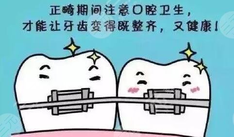 牙齿矫正的费用会受到哪些因素影响