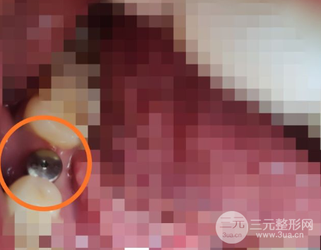 华西口腔医院价格表