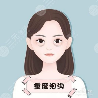 成都自体脂肪填充泪沟多少钱?附成都自体脂肪填充泪沟价格表 成都自体脂肪填充泪沟多少钱?附成都自体脂肪填充泪沟价格表