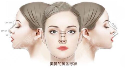 上海九院隆鼻案例分享